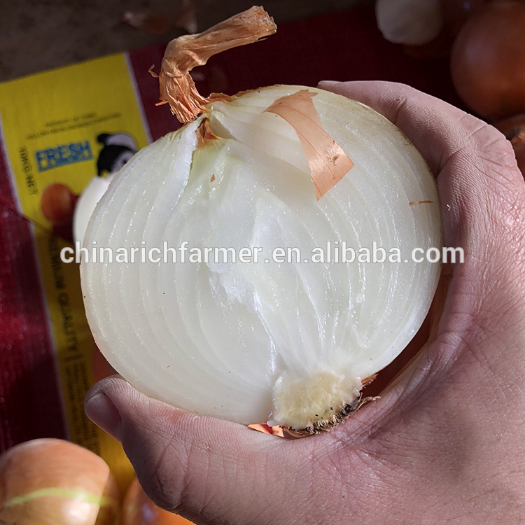 China 9cm Yellow Onion Market Prices