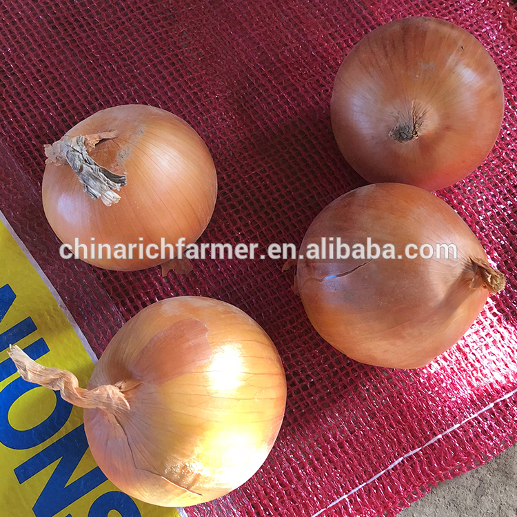 China 9cm Yellow Onion Market Prices