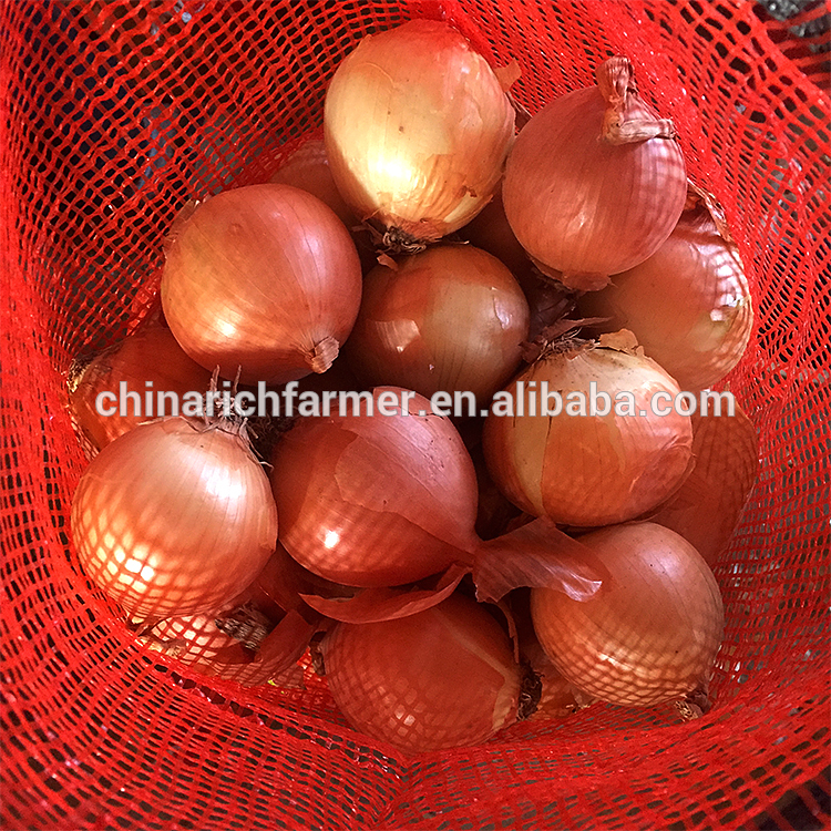China 9cm Yellow Onion Market Prices