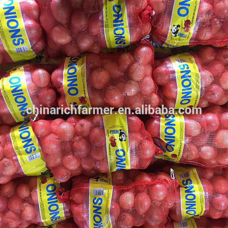 China 9cm Yellow Onion Market Prices
