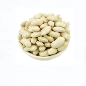  Ethiopian   red   kidney   beans 