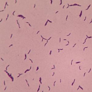 Bifidobacterium breve BBr60 products,China Bifidobacterium breve BBr60 ...